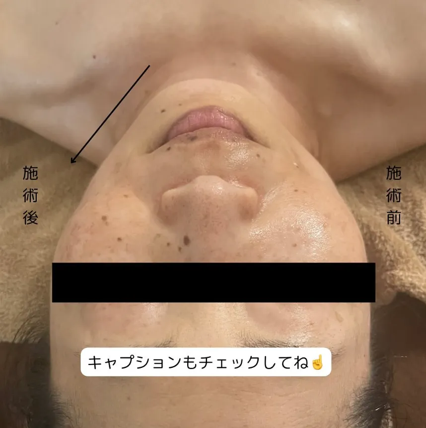 ドライヘッドスパ+フェイシャル ビフォーアフター